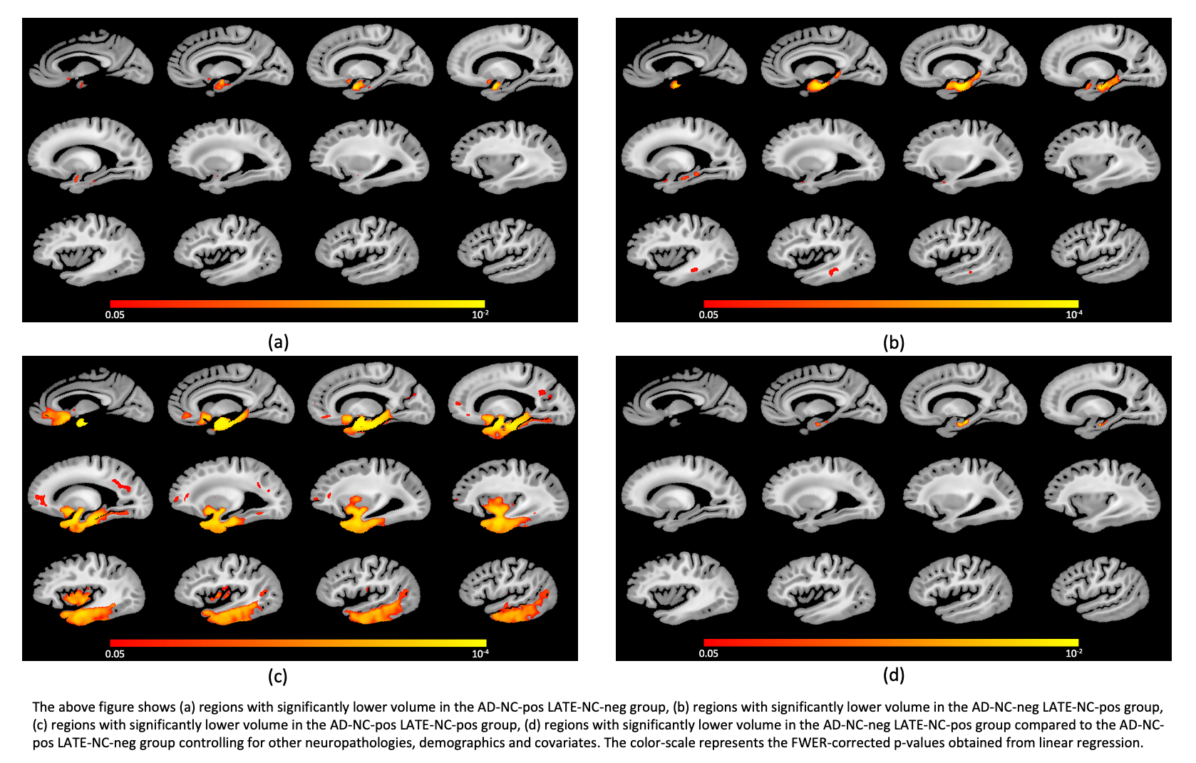 In-Vivo MRI Tangles Marker visual summary